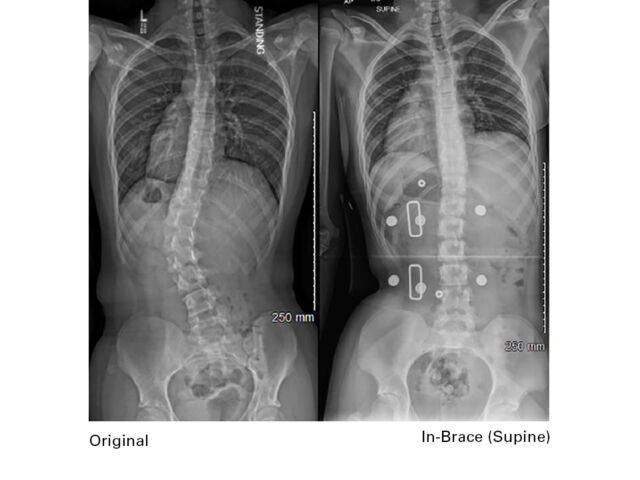X Rays A Set1
