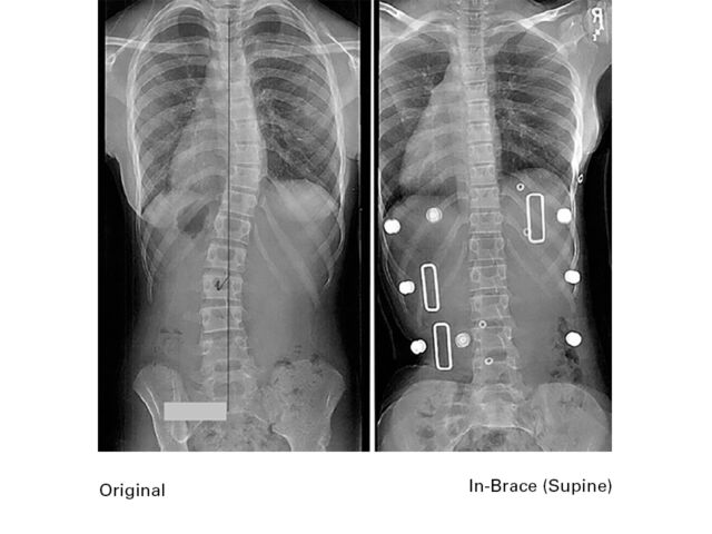X Rays B Set1