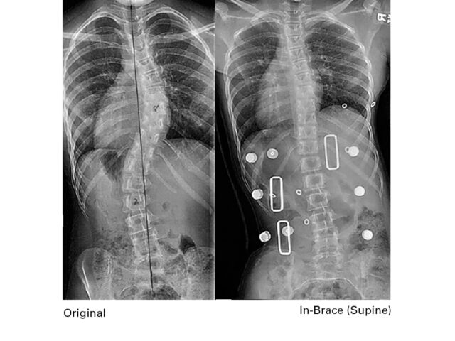 X Rays C Set1