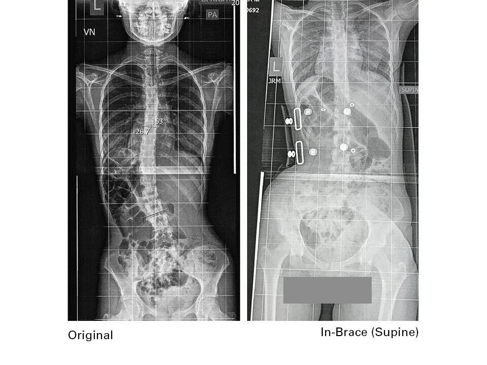 X Rays A Set2