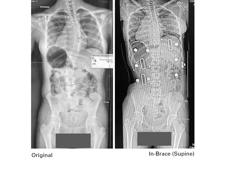 X Rays C Set2