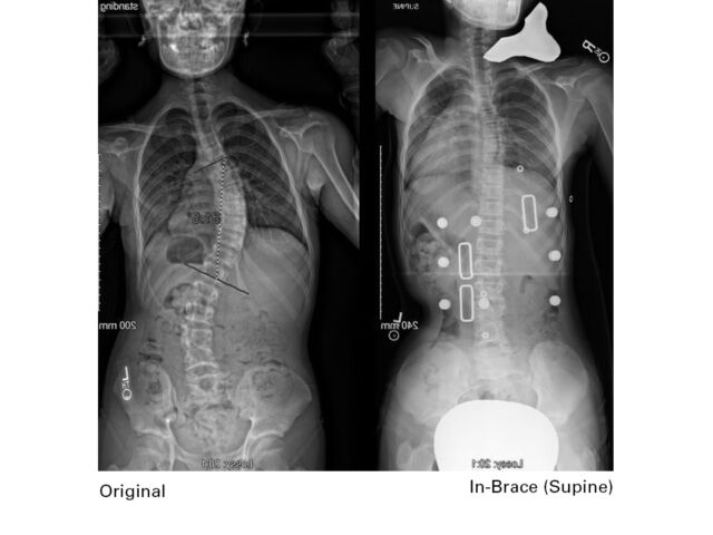 X Rays A Set3