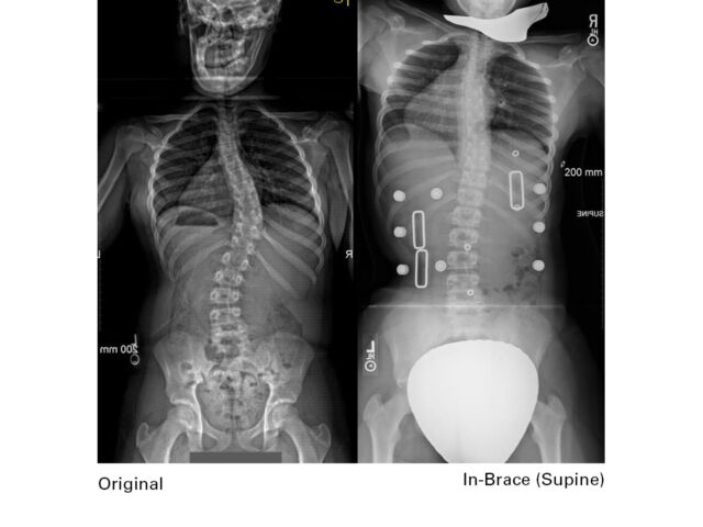 X Rays B Set3