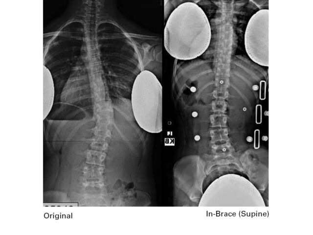 X Rays C Set3
