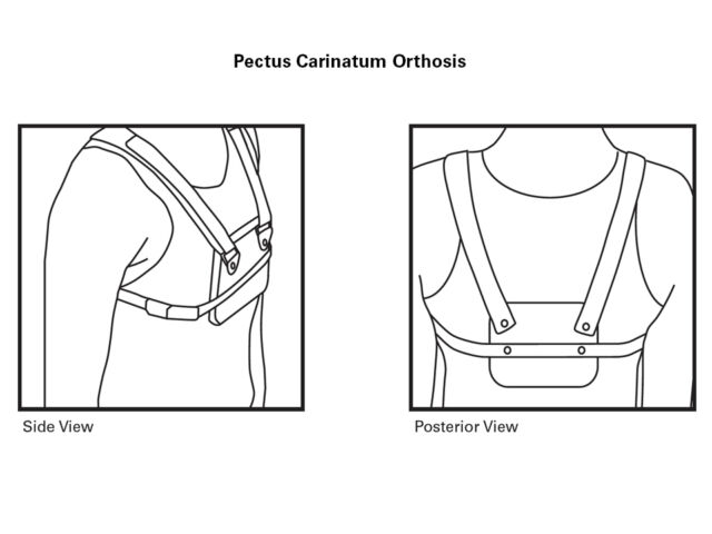 Pectus Wear Drawings
