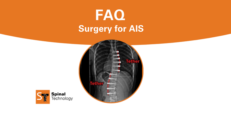 FAQ surgery