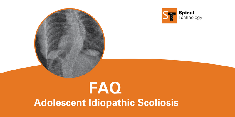 ST Adolescent Idiopathic Scoliosis Blog Header