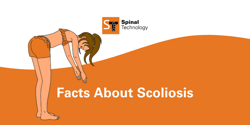 ST Facts About Scoliosis Blog Header Title