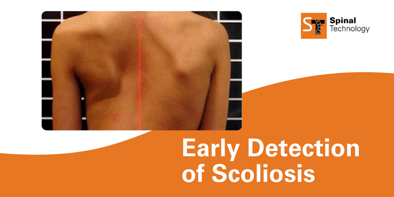 ST Early Detection of Scoliosis Blog Header