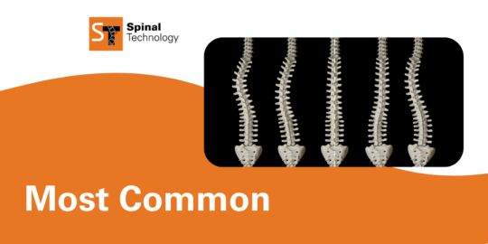 ST Types of scoliosis Blog Header 1