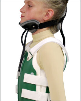 Cervical Extension Lateral View
