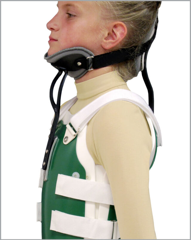 Cervical Extension Lateral View