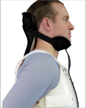 Cervical Extension Lateral View