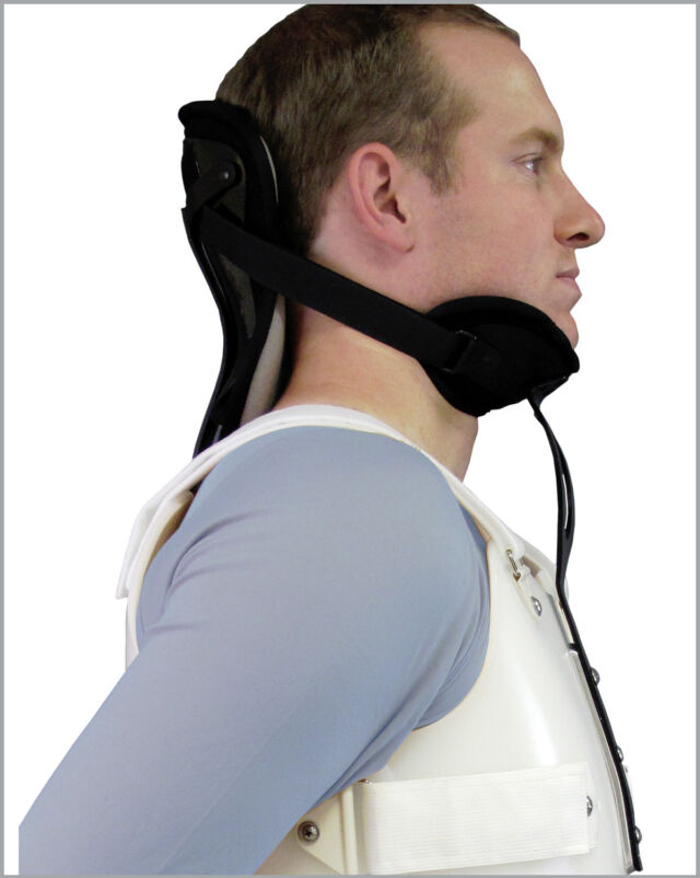 Cervical Extension Lateral View