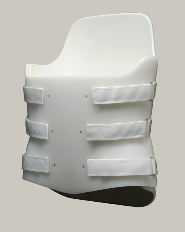 Finished Low Anterior / High Posterior Bivalve