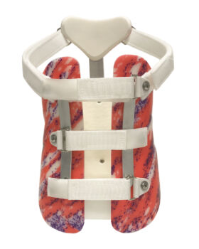 Kyphosis Orthosis - Posterior Aluminum Reinforcements
