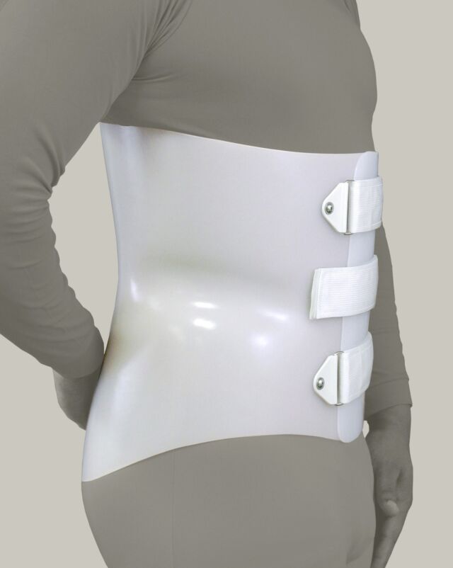 LSO Anterior Overlap - Lateral View