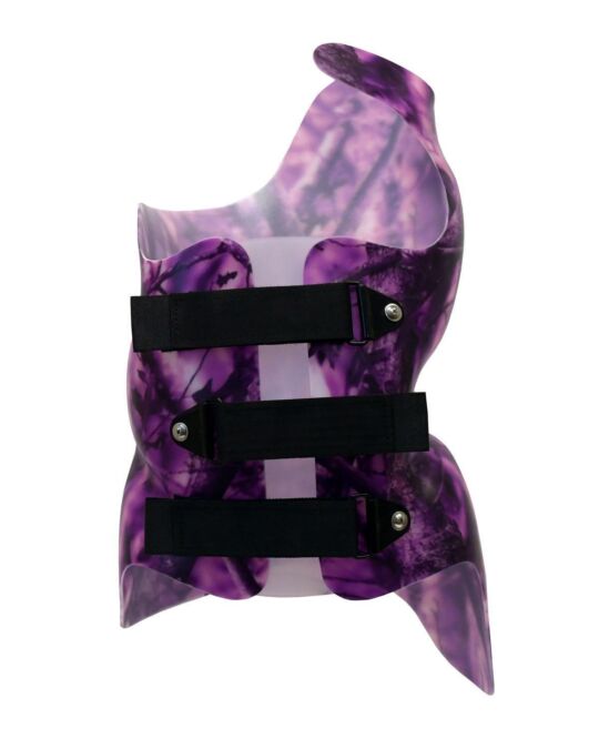 SCT Chêneau (Style) Orthosis - Anterior View