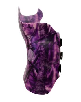 SCT Chêneau (Style) Orthosis - Right Lateral View