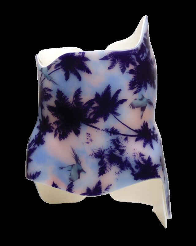SCT 3D Boston (Style) Scoliosis Orthosis - Anterior View