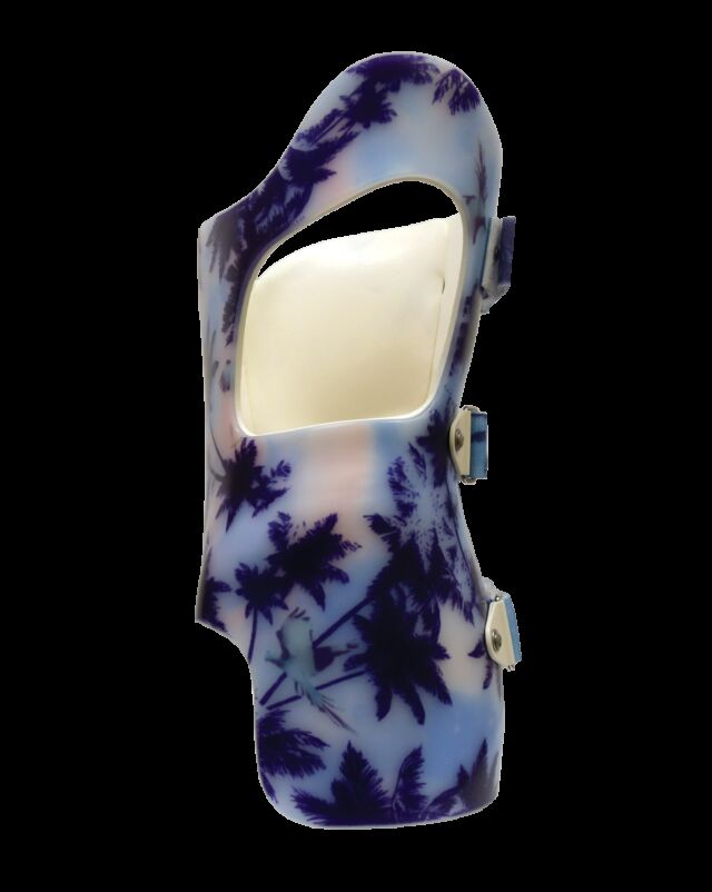 SCT 3D Boston (Style) Scoliosis Orthosis - 3. Full size window