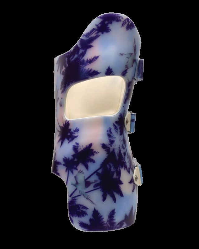 SCT 3D Boston (Style) Scoliosis Orthosis - 2. Medium size window with void area