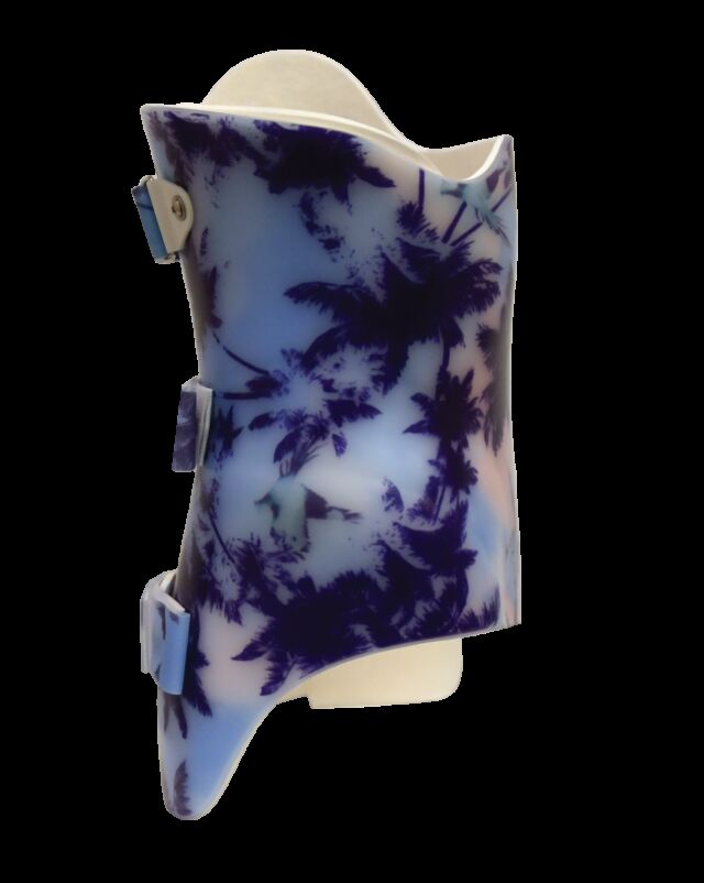 SCT 3D Boston (Style) Scoliosis Orthosis - Right Lateral View