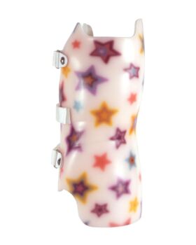 SCT 3D Wilmington (Style) Scoliosis Orthosis - Left Lateral View