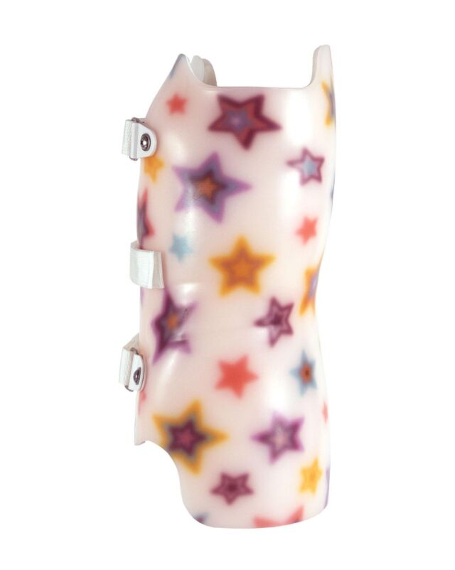 SCT 3D Wilmington (Style) Scoliosis Orthosis - Left Lateral View