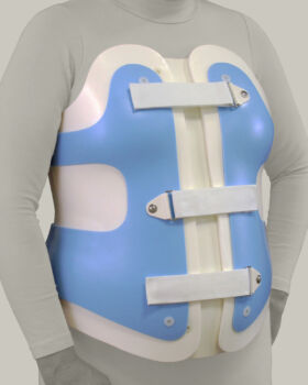 Flex Foam® 1 - TLSO - Anterior View