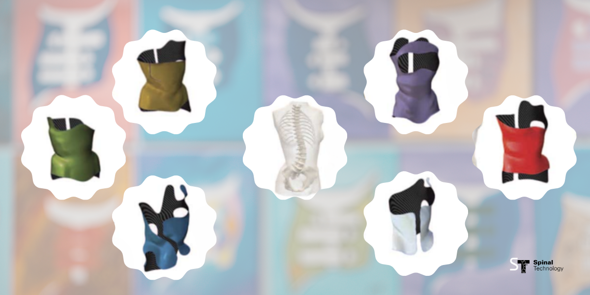 Variations of Brace Design