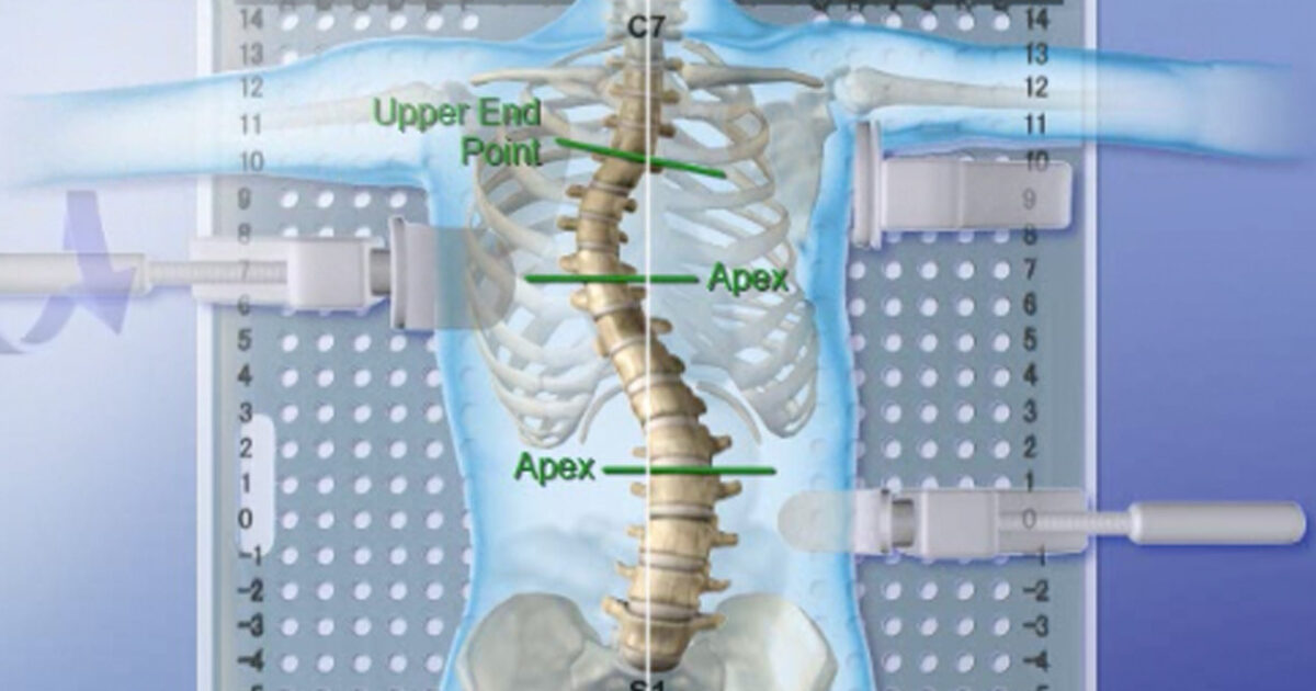 Spinal Technology | The Providence Nocturnal Scoliosis® System