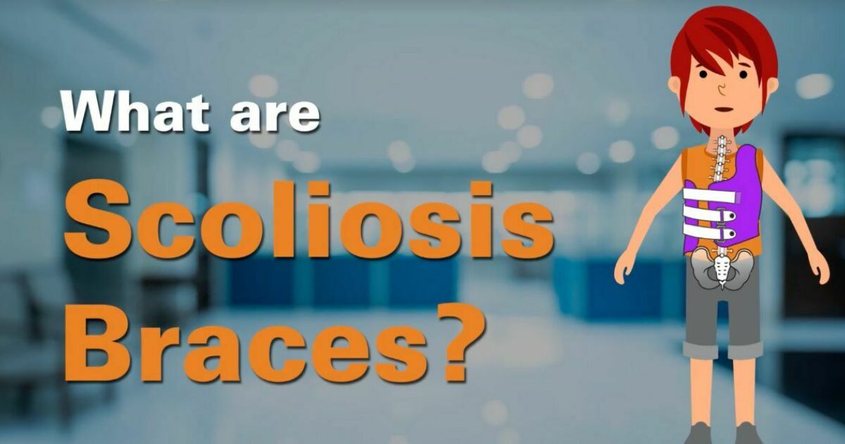 Spinal Technology | What are Scoliosis Braces?