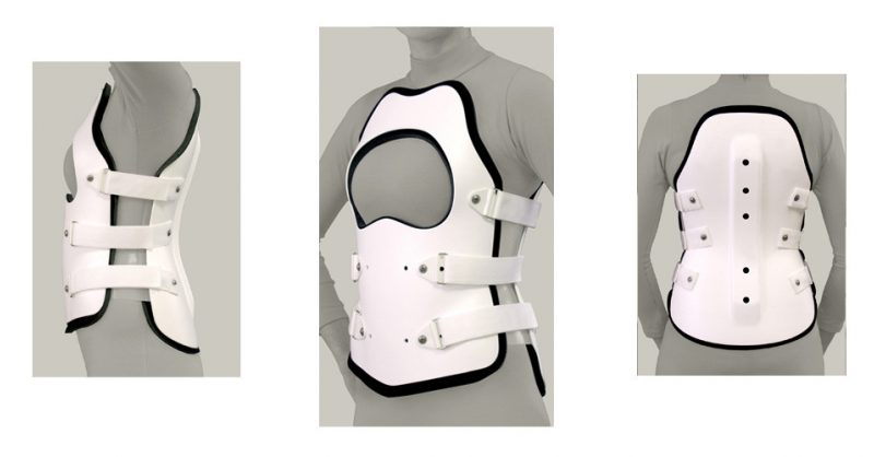 Spinal Technologies S.T.O.P I clamshell brace, preowned, female